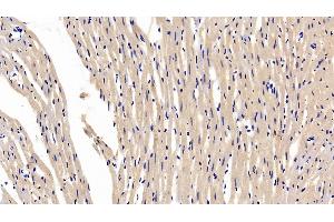 Immunohistochemistry (IHC) image for anti-Intelectin 1 (Galactofuranose Binding) (ITLN1) (AA 28-270) antibody (ABIN7432901)