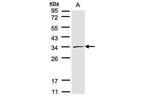 CDK4 抗体