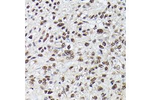 Immunohistochemistry of paraffin-embedded Human lung using SRSF2 antibody (ABIN1682677, ABIN3017915, ABIN3017916, ABIN5664377 and ABIN6220303) at dilution of 1:100 (40x lens). (SRSF2 抗体  (AA 1-75))
