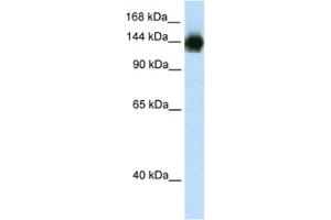 Western Blotting (WB) image for anti-Timeless Homolog (TIMELESS) antibody (ABIN2461712) (TIMELESS 抗体)