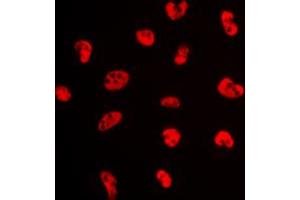 Immunofluorescent analysis of Estrogen Receptor alpha (pS106) staining in MCF7 cells.