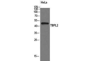Western Blotting (WB) image for anti-TATA Box Binding Protein Like 2 (Tbpl2) (Internal Region) antibody (ABIN3177636) (Tbpl2 抗体  (Internal Region))
