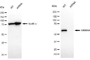 Western blotting analysis using catalase antibody (ABIN7797919). (Recombinant Catalase 抗体)