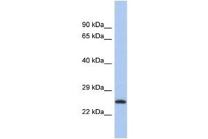 Western Blotting (WB) image for anti-Chromosome 9 Open Reading Frame 173 (C9ORF173) (N-Term) antibody (ABIN2786549) (C9ORF173 抗体  (N-Term))