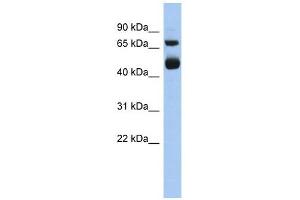 ALOX15 antibody used at 1 ug/ml to detect target protein. (ALOX15 抗体  (Middle Region))
