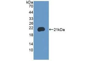 Detection of Recombinant BRD8, Mouse using Polyclonal Antibody to Bromodomain Containing Protein 8 (BRD8) (BRD8 抗体  (AA 797-951))