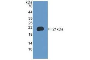Detection of Recombinant BRD8, Mouse using Polyclonal Antibody to Bromodomain Containing Protein 8 (BRD8)