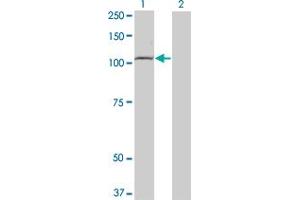 Western Blot analysis of TLR8 expression in transfected 293T cell line by TLR8 monoclonal antibody (M01), clone 4C6. (TLR8 抗体  (AA 723-825))
