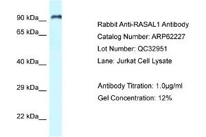 Western Blotting (WB) image for anti-RAS Protein Activator Like 1 (GAP1 Like) (RASAL1) (C-Term) antibody (ABIN2789073) (RASAL1 抗体  (C-Term))