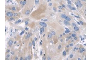Detection of CK2 in Human Esophagus Tissue using Polyclonal Antibody to Keratin 2 (CK2) (Keratin 2 抗体  (AA 7-160))