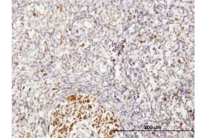 Immunoperoxidase of purified MaxPab antibody to MCM6 on formalin-fixed paraffin-embedded human lymph node. (MCM6 抗体  (AA 1-821))