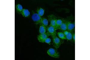 IF analysis of CD59 using anti-CD59 antibody (ABIN3043396).