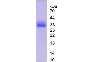 SDS-PAGE analysis of Mouse CDK1 Protein. (CDK1 蛋白)