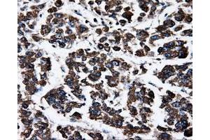 Immunohistochemistry (IHC) image for anti-ATP Synthase, H+ Transporting, Mitochondrial F1 Complex, beta Polypeptide (ATP5B) antibody (ABIN2716440)