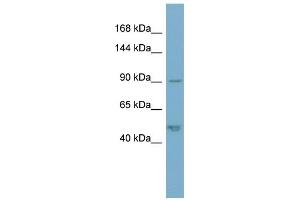 Western Blotting (WB) image for anti-Plakophilin 2 (PKP2) (N-Term) antibody (ABIN2786784)