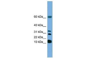 Western Blot showing LTC4S antibody used at a concentration of 1. (LTC4S 抗体  (N-Term))