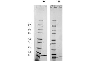 SDS-PAGE of Human Monocyte Chemotactic Protein-2 (CCL8) Recombinant Protein SDS-PAGE of Rat Monocyte Chemotactic Protein-1 (CCL2) Recombinant Protein. (CCL8 蛋白)
