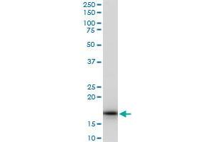 RPS17 polyclonal antibody (A03), Lot # 060529JCS1. (RPS17 抗体  (AA 36-135))