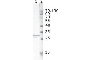 Western Blot testing of HIV-1 recombinant Nef protein. (HIV-1 Nef (AA 150-158) 抗体)