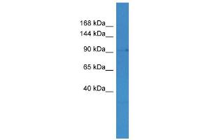 WB Suggested Anti-MLXIP Antibody Titration: 0. (MLXIP 抗体  (C-Term))