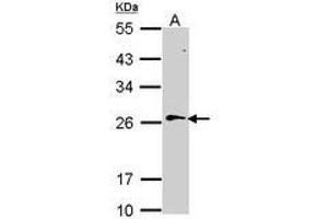 Image no. 2 for anti-RAN, Member RAS Oncogene Family (RAN) (AA 1-179) antibody (ABIN467626) (RAN 抗体  (AA 1-179))