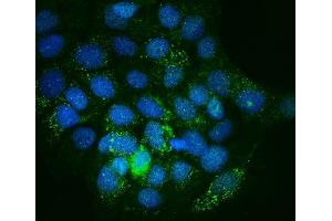 IF analysis of Integrin linked ILK using anti-Integrin linked ILK antibody (ABIN7602632). (ILK 抗体  (AA 9-452))