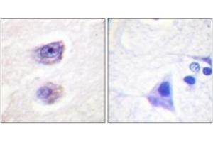 Immunohistochemistry analysis of paraffin-embedded human brain, using Tyrosine Hydroxylase (Phospho-Ser8) Antibody. (Tyrosine Hydroxylase 抗体  (pSer8))