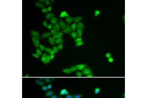 Immunofluorescence analysis of U2OS cells using PJA2 Polyclonal Antibody (PJA2 抗体)