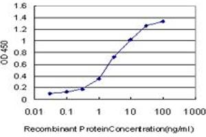 Detection limit for recombinant GST tagged IRF2 is approximately 0. (IRF2 抗体  (AA 216-315))