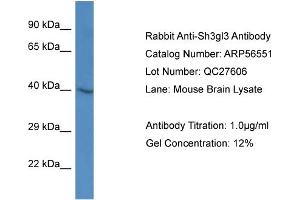 Western Blotting (WB) image for anti-Endophilin-A3 (SH3GL3) (Middle Region) antibody (ABIN2786768) (SH3GL3 抗体  (Middle Region))