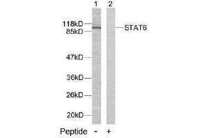 Image no. 2 for anti-Signal Transducer and Activator of Transcription 6, Interleukin-4 Induced (STAT6) (Tyr641) antibody (ABIN197184) (STAT6 抗体  (Tyr641))