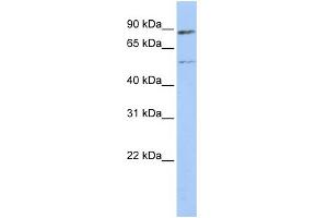 WB Suggested Anti-ESR1 Antibody Titration:  0. (Estrogen Receptor alpha 抗体  (Middle Region))