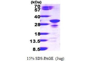 SDS-PAGE (SDS) image for Secretogranin V (7B2 Protein) (SCG5) (AA 27-212) protein (His tag) (ABIN667198)