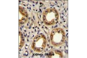 CXCR3 Antibody (Center) (ABIN654129 and ABIN2844003) immunohistochemistry analysis in formalin fixed and paraffin embedded human kidney tissue followed by peroxidase conjugation of the secondary antibody and DAB staining. (CXCR3 抗体  (AA 140-167))
