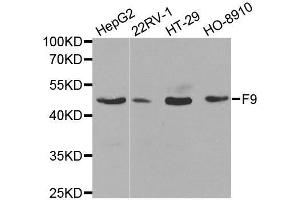 Western blot analysis of extracts of various cell lines, using F9 antibody. (Coagulation Factor IX 抗体  (AA 29-192))