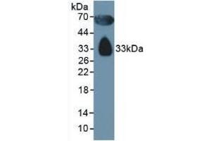 Detection of APOD in Human Serum using Polyclonal Antibody to Apolipoprotein D (APOD) (Apolipoprotein D 抗体  (AA 21-189))