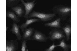 Immunofluorescent staining of HeLa (ATCC CCL-2) cells. (Crk 抗体  (AA 102-304))
