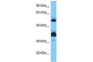 Host:  Rabbit  Target Name:  SP7  Sample Type:  Jurkat Whole Cell lysates  Antibody Dilution:  0.