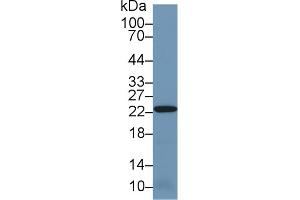 Western blot analysis of Mouse Kidney lysate, using Human PRDX2 Antibody (1 µg/ml) and HRP-conjugated Goat Anti-Rabbit antibody ( (Peroxiredoxin 2 抗体  (AA 6-164))