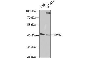 Western blot analysis of extracts of various cell lines, using MVK antibody (ABIN6128256, ABIN6144204, ABIN6144205 and ABIN6220991) at 1:1000 dilution. (MVK 抗体  (AA 40-300))