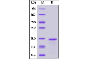 Human SLC1A5, His Tag, TrxA Tag on  under reducing (R) condition. (SLC1A5 Protein (AA 154-224) (His tag,TRX tag))