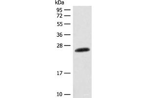 Western blot analysis of Mouse skin tissue lysate using CSNK2B Polyclonal Antibody at dilution of 1:400 (CSNK2B 抗体)