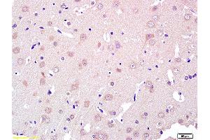 Formalin-fixed and paraffin embedded rat brain labeled with Rabbit Anti ROR1/ROR alpha Polyclonal Antibody, Unconjugated (ABIN1387717) at 1:200 followed by conjugation to the secondary antibody and DAB staining (ROR1 抗体  (AA 301-360))
