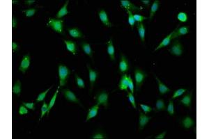 Immunofluorescence staining of NIH/3T3 cells with ABIN7157862 at 1:66, counter-stained with DAPI. (Laminin 抗体  (AA 974-1162))