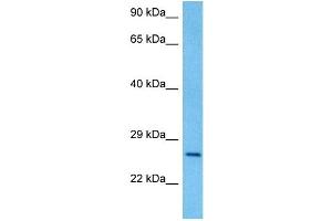 Host:  Rat  Target Name:  PAX4  Sample Tissue:  Rat Brain  Antibody Dilution:  1ug/ml (PAX4 抗体  (Middle Region))