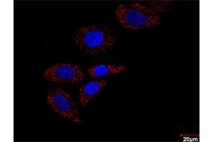 Confocal microscopy image of Proximity Ligation Assay of protein-protein interactions between HDAC2 and HIF1A.