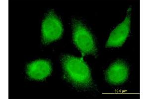 Immunofluorescence of monoclonal antibody to CBLL1 on HeLa cell. (CBLL1 抗体  (AA 1-100))