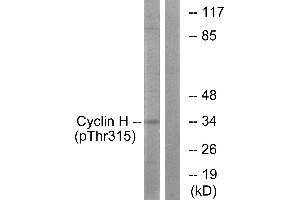 Western blot analysis of extracts from HeLa cells, using Cyclin H (Phospho-Thr315) antibody.