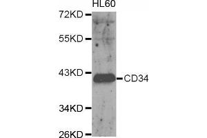 Western blot analysis of extracts of HL60 cell, using CD34 antibody. (CD34 抗体  (AA 32-290))
