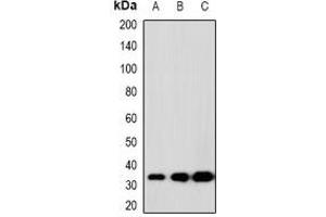 Western blot analysis of SCP3 expression in K562 (A), 22RV1 (B), H480 (C) whole cell lysates. (SYCP3 抗体)